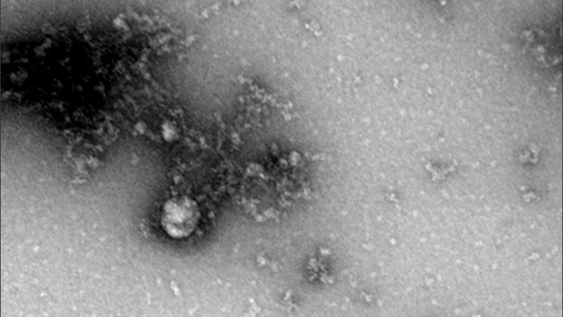 La fotografía del virus bajo el microscopio fue obtenida en el marco de un estudio.