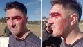 Violencia en el fútbol: un entrenador le golpeó la cara a piñas al árbitro de un partido de fútbol de reserva en Rufino